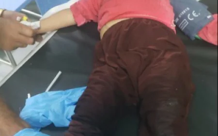 إصابة ثلاثة أطفال أشقاء في انفجار جسم حربي بالضالع