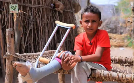 منظمة: مقتل واصابة 30 طفلاً جراء الألغام منذ مطلع العام 2024