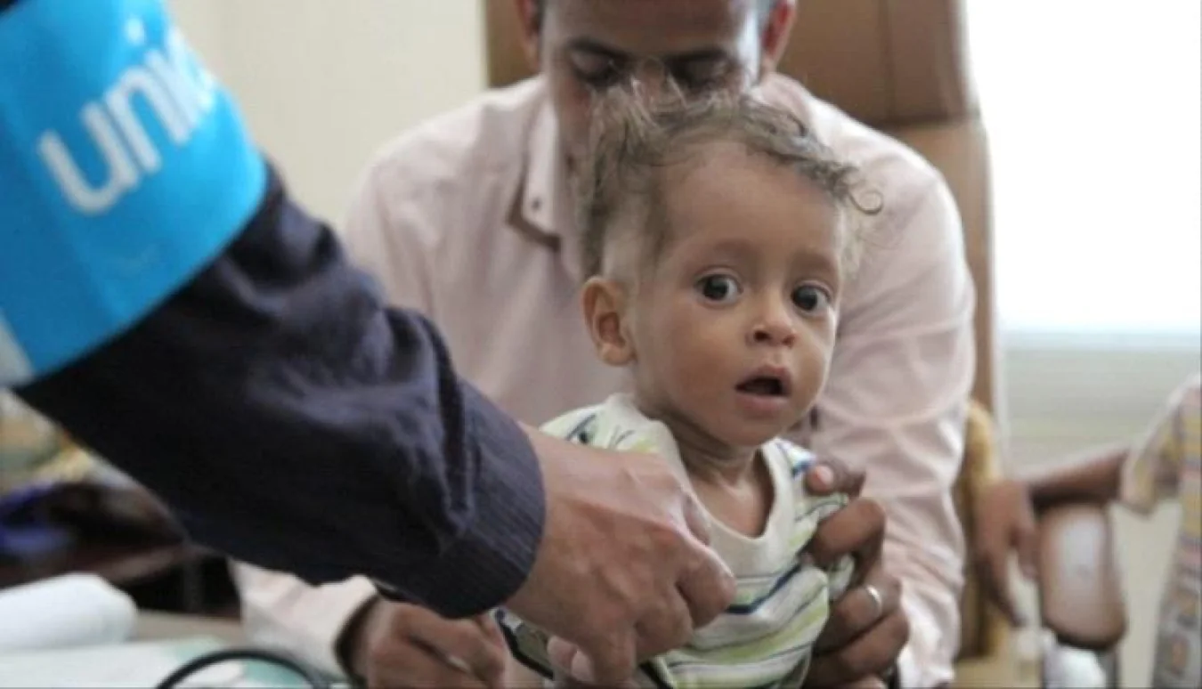تمويل أمريكي إضافي لدعم علاج الأطفال من سوء التغذية في اليمن