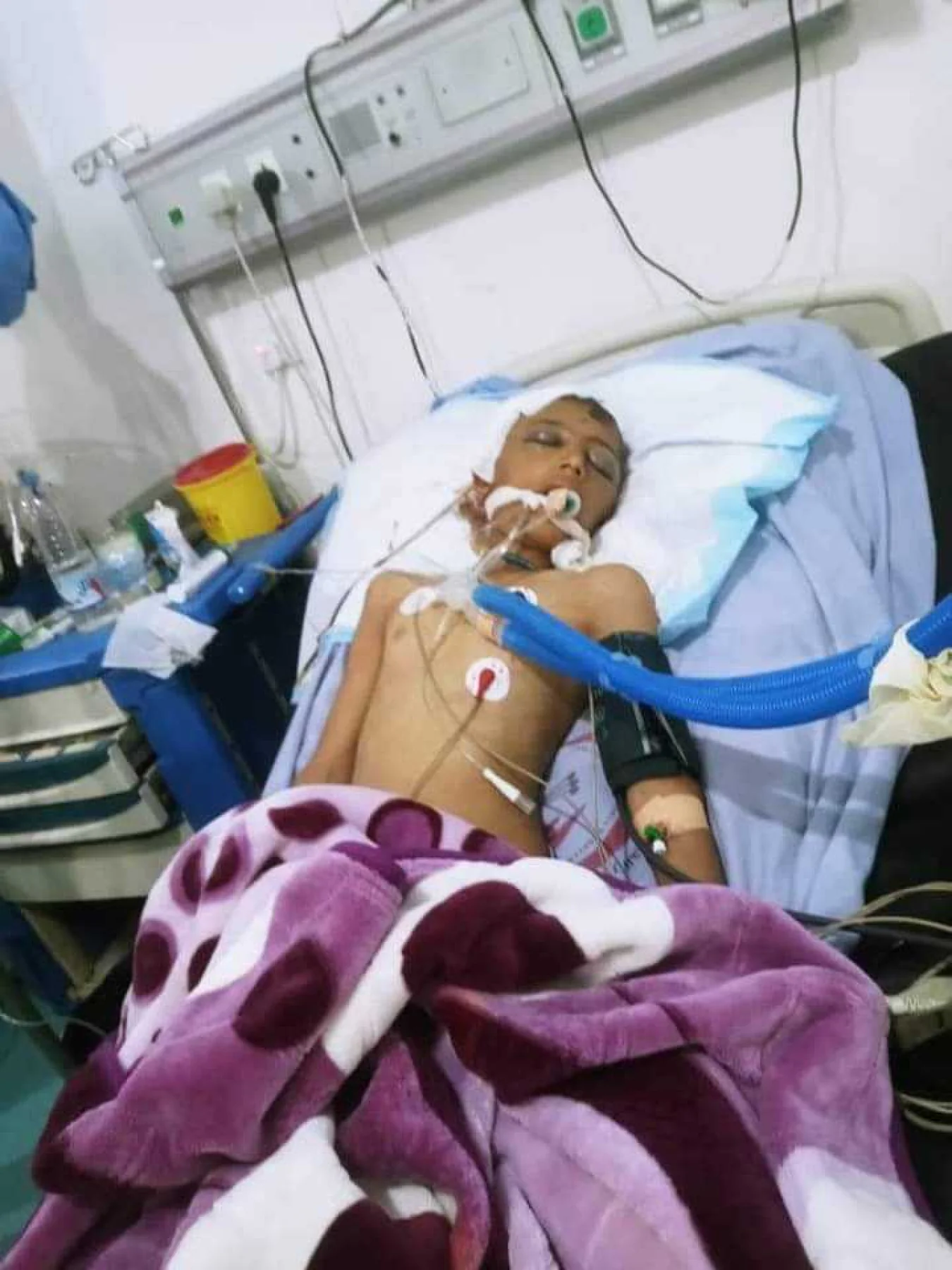 إصابة طفل برصاص مسلح اثر نزاع في محافظة اب