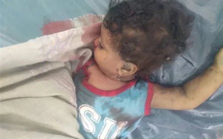 مقتل طفل اثر سقوط قذيفة جنوب محافظة تعز