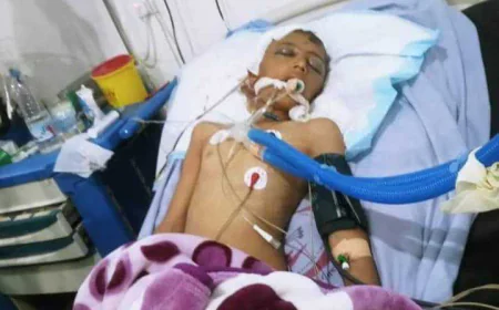 إصابة طفل برصاص مسلح اثر نزاع في محافظة اب