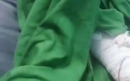 إب.. مستشفى الثورة يرفض اخراج طفل يتيم الا بعد سداد تكاليف عملية جراحية أجريت له