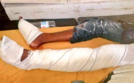 انفجار لغم أرضي يتسبب بإصابة طفل في الحديدة
