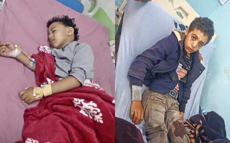إصابة طفلين برصاص مسلحين في محافظة إب