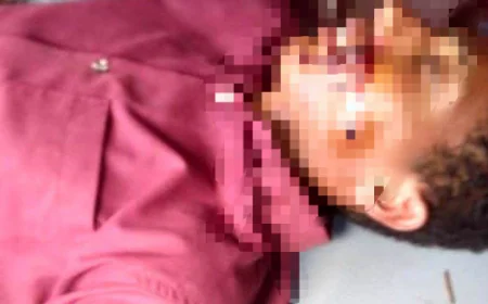 إصابة طفل برصاص قناص في محافظة لحج