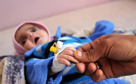 الصحة العالمية: ما لا يقل 823 ألف طفل وامرأة سيعانون من سوء التغذية