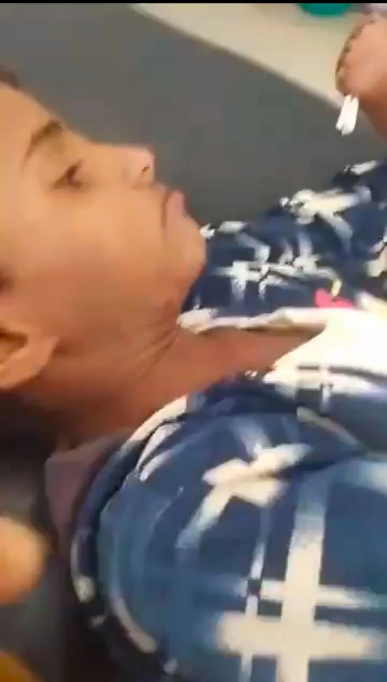 بترت يده اليسرى.. إصابة طفل في انفجار عبوة ناسفة في حجة