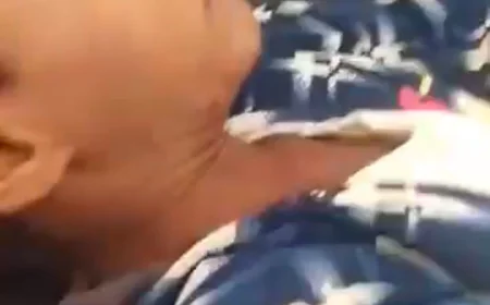 بترت يده اليسرى.. إصابة طفل في انفجار عبوة ناسفة في حجة