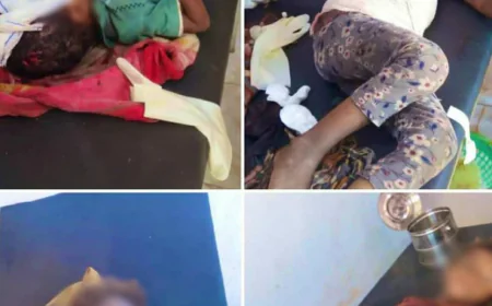 مقتل طفل واصابة 3 آخرين من أسرة واحدة في قصف استهدف منزلهم في تعز