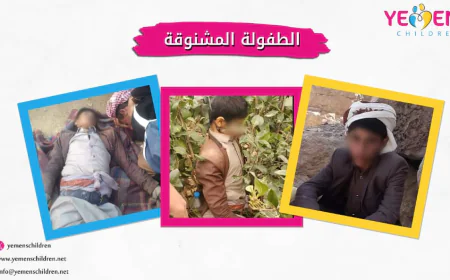 الطفولة المشنوقة