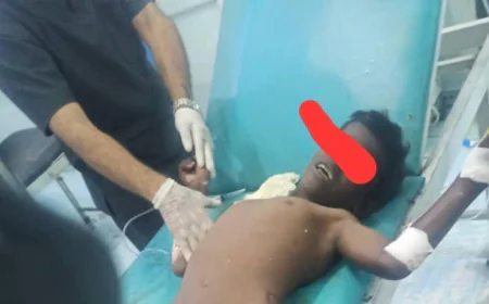 إصابة طفل ووالده بانفجار لغم في الحديدة