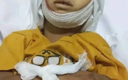 حادث مؤسف يودي بحياة طفل في مشرعة وحدنان بتعز