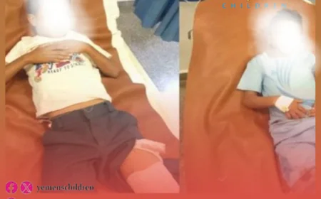 انفجار يهدد حياة الأطفال في تعز