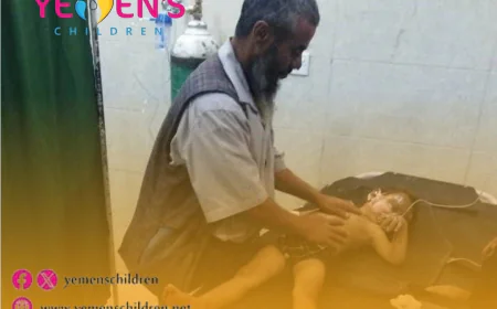 إصابة أربعة أطفال في حريق بمخيم للنازحين شرقي مأرب