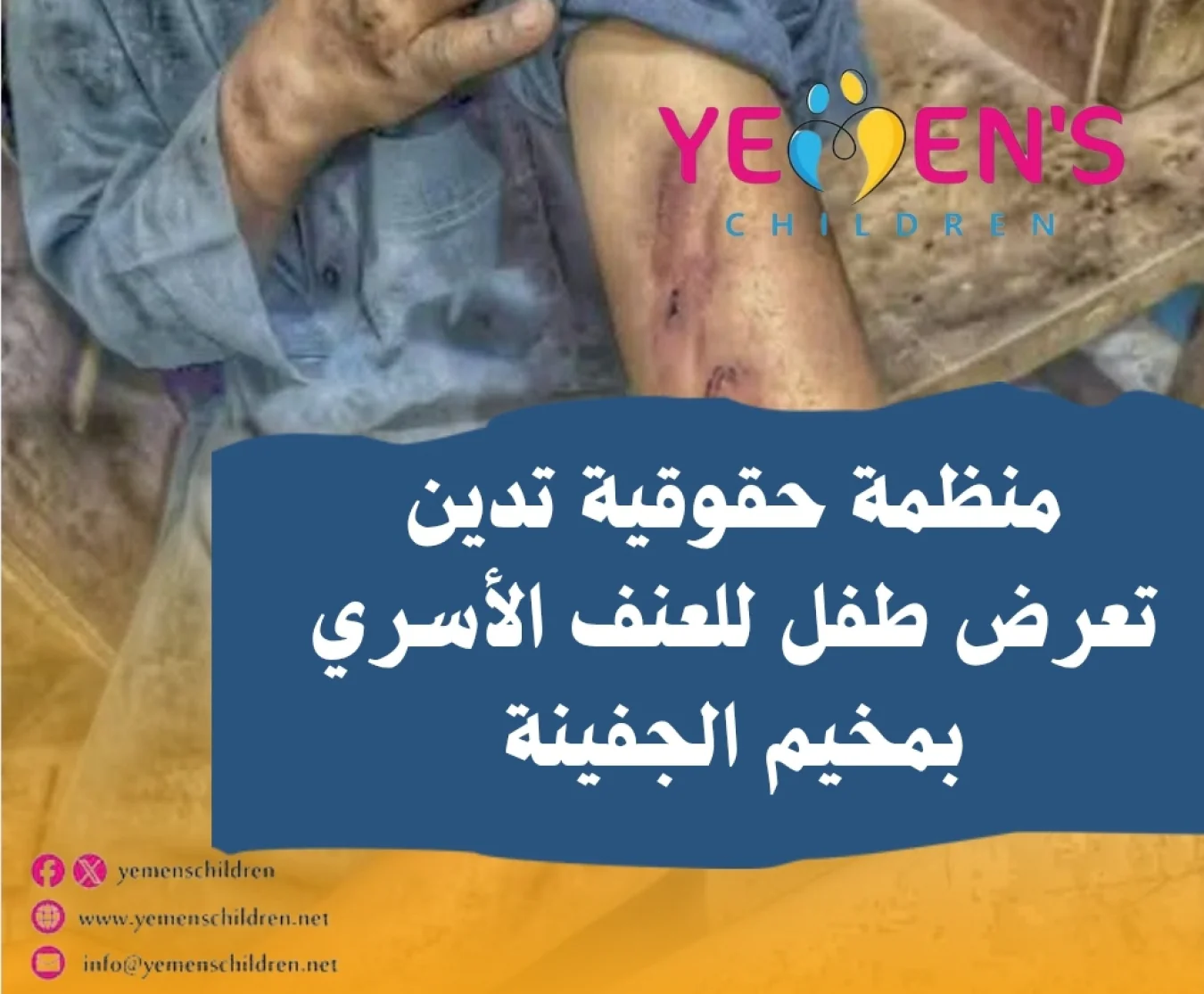 منظمة حقوقية تدين تعرض طفل للعنف الأسري بمخيم الجفينة