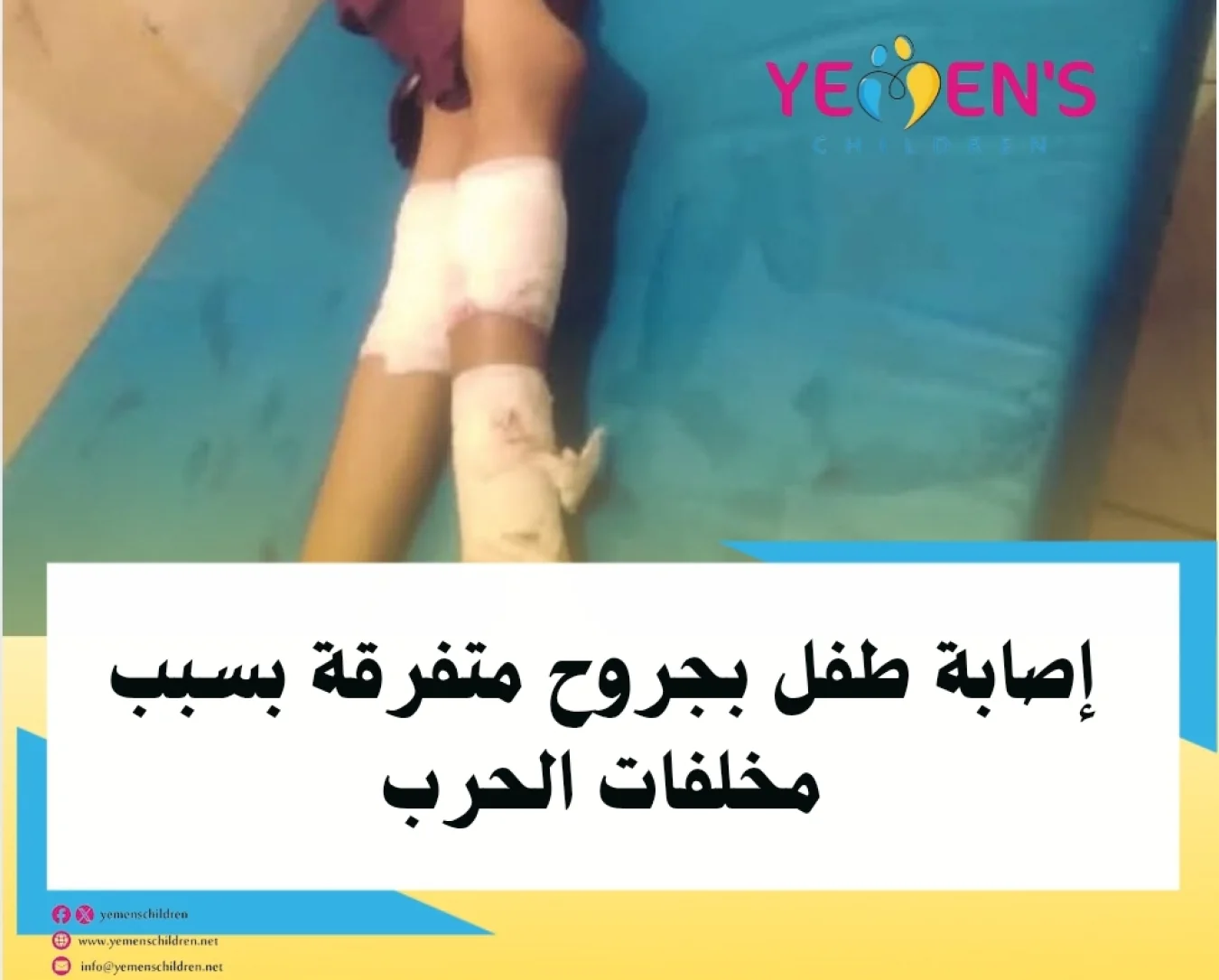 إصابة طفل بجروح متفرقة بسبب مخلفات الحرب