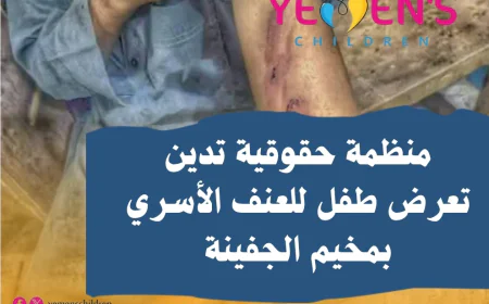منظمة حقوقية تدين تعرض طفل للعنف الأسري بمخيم الجفينة