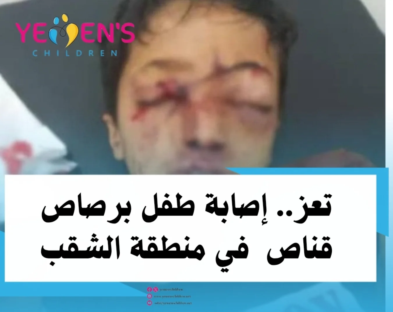 تعز.. إصابة طفل برصاص قناص في منطقة الشقب