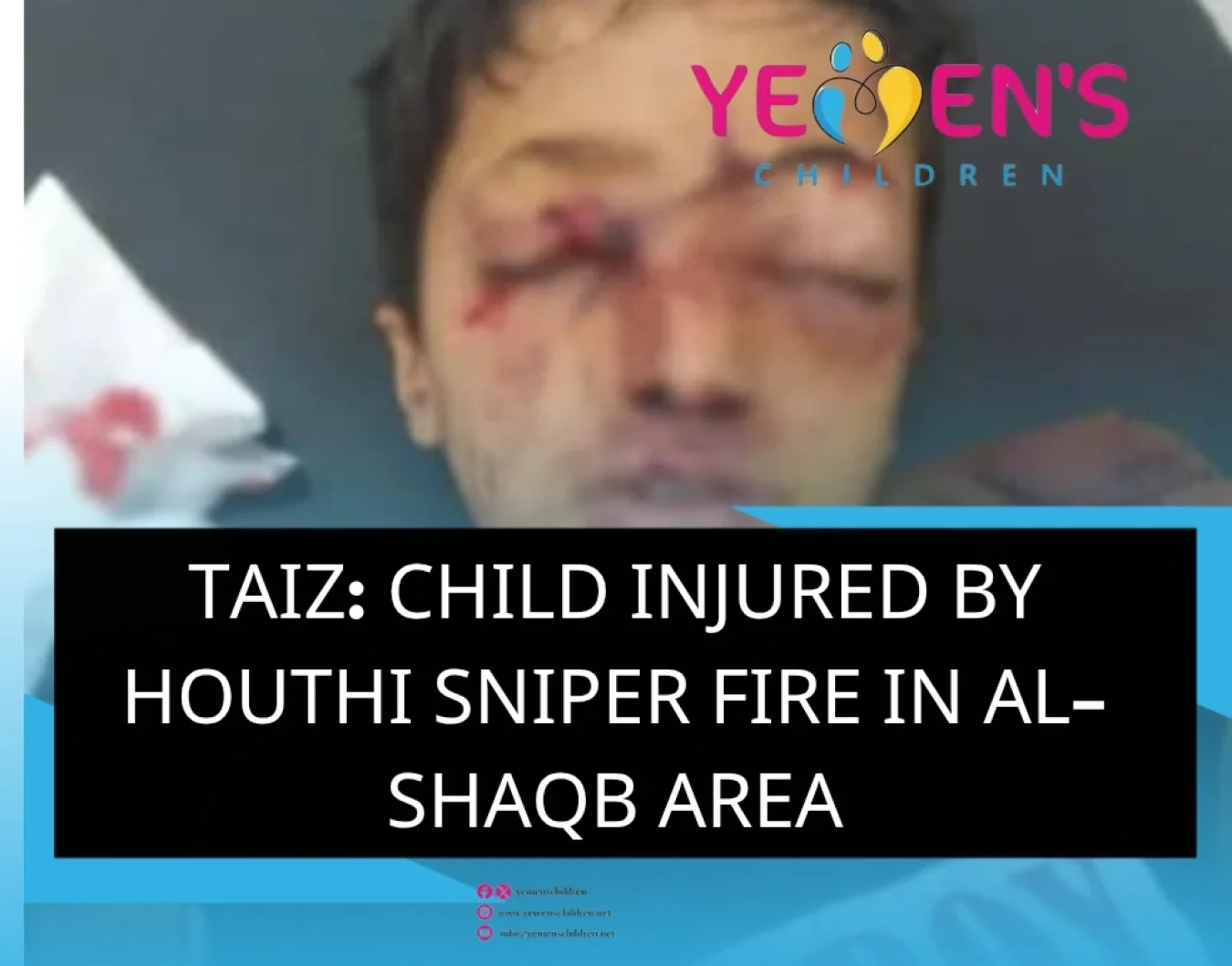Taiz: Child Injured by Houthi Sniper Fire in Al-Shaqb Area