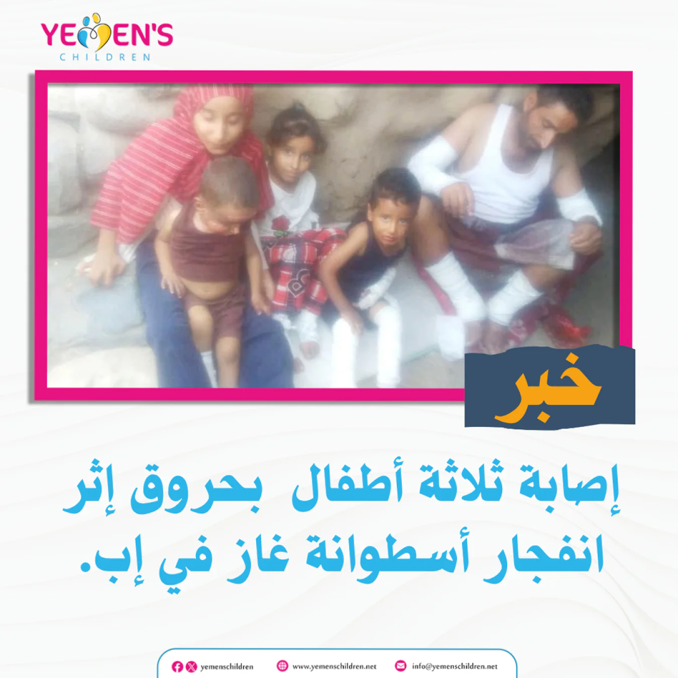 إصابة ثلاثة ثلاثة أطفال بحروق إثر انفجار أسطوانة غاز في محافظة إب.