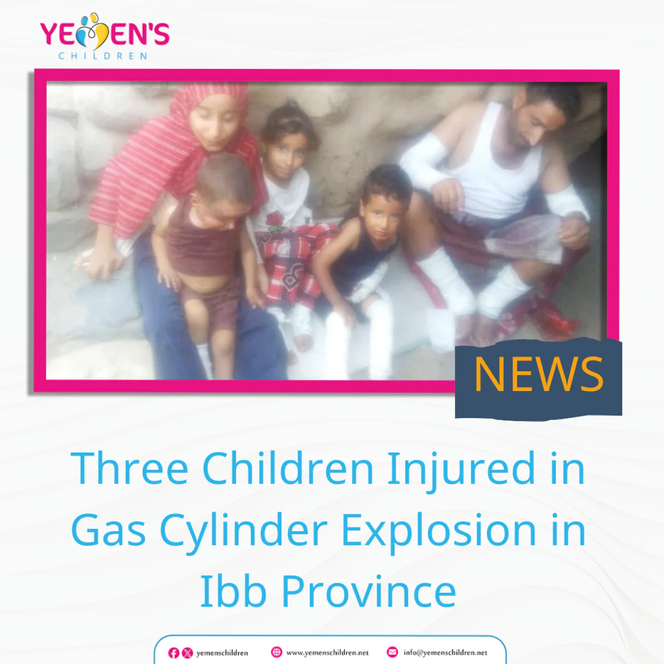 Three Children Injured in Gas Cylinder Explosion in Ibb Province