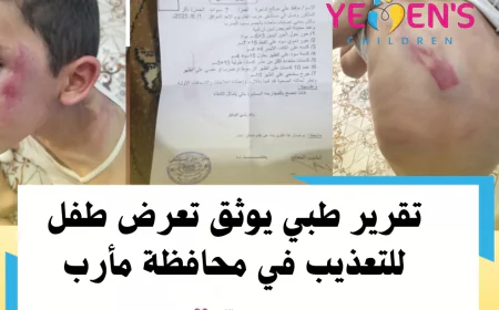 تقرير طبي يوثق تعرض طفل للتعذيب في محافظة مأرب