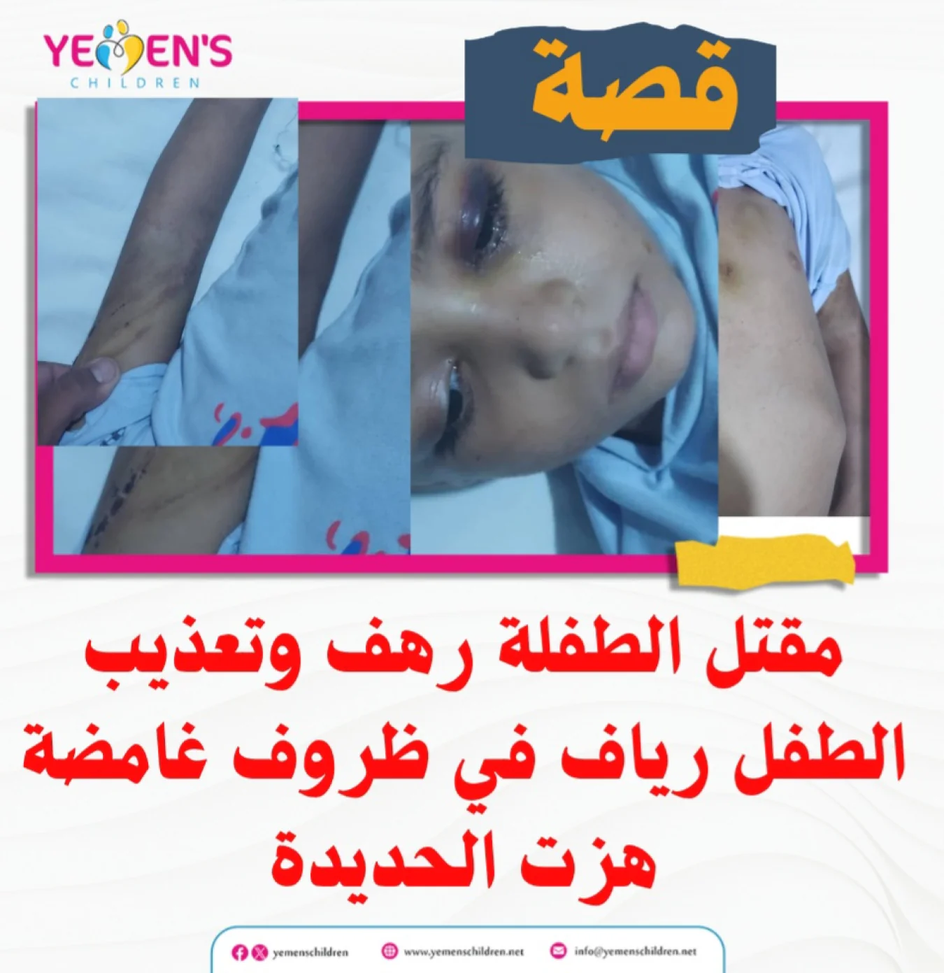 مقتل الطفلة رهف وتعذيب الطفل رياف في ظروف غامضة هزت الحديدة