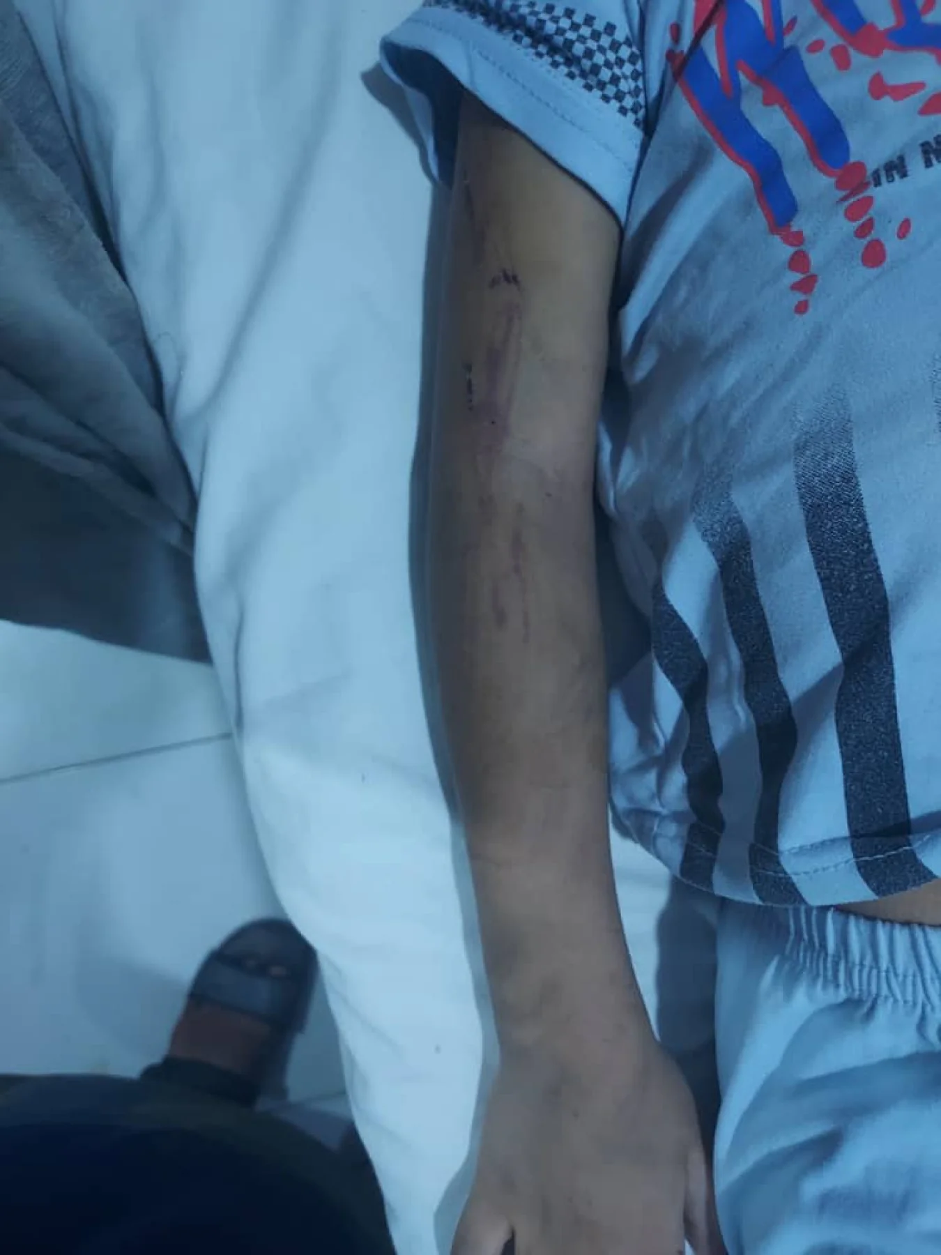 Death of Young Girl Rahaf and Torture of Her Brother Riyaf in Mysterious Circumstances Shake Al-Hodeidah