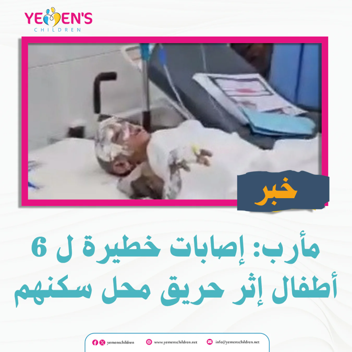 مأرب: إصابات خطيرة ل 6 أطفال إثر حريق محل سكنهم