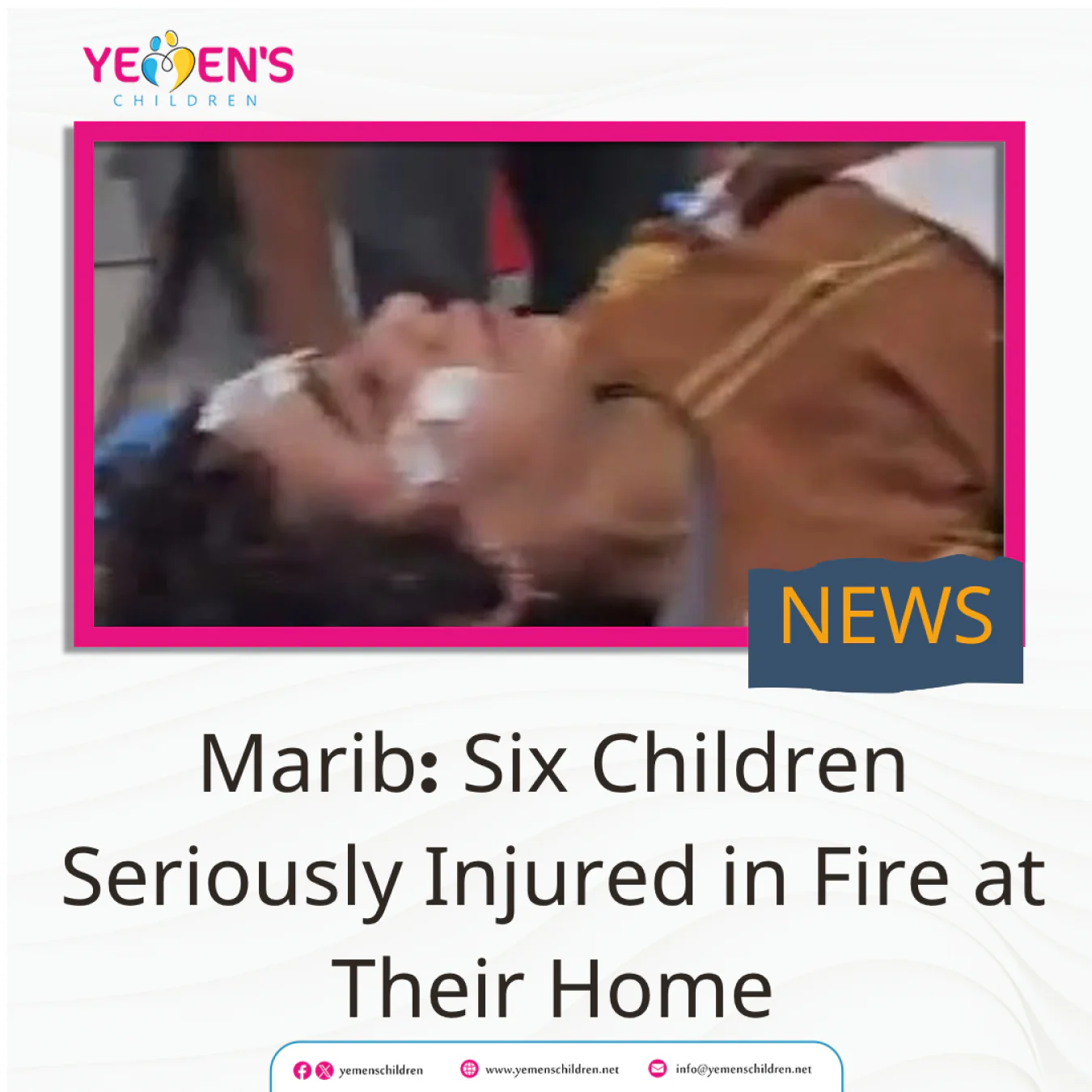 Marib: Six Children Seriously Injured in Fire at Their Home