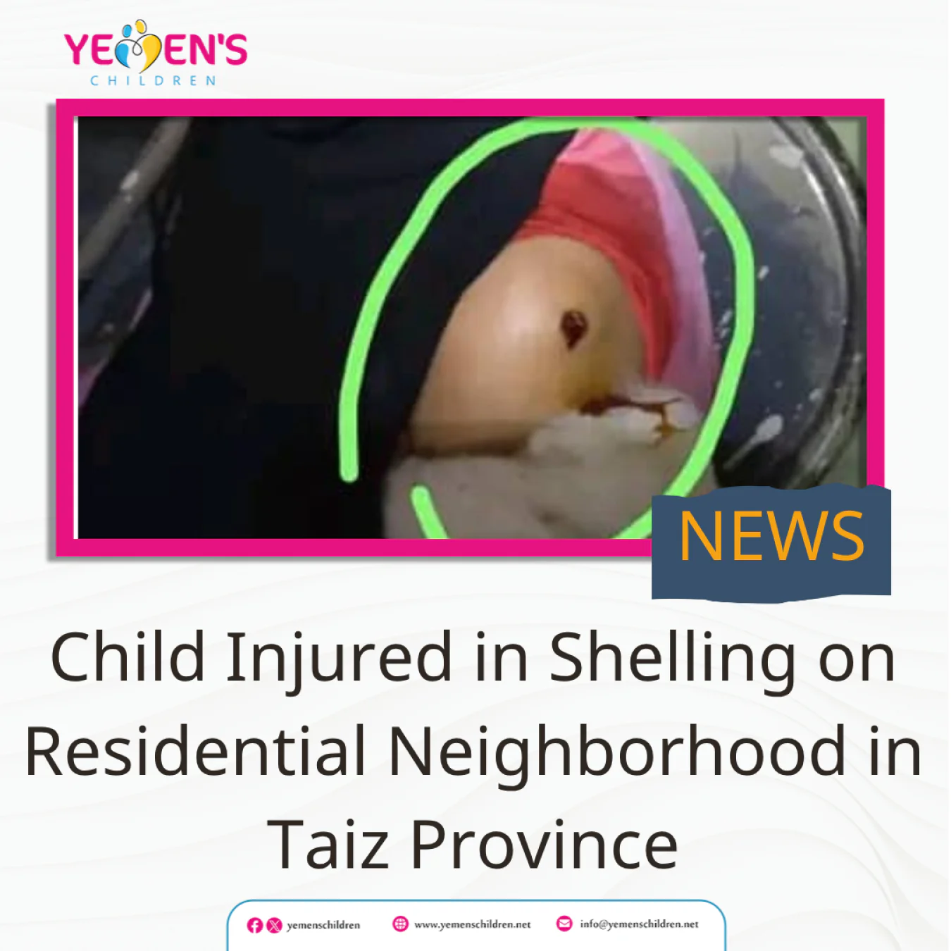 Child Injured in Shelling on Residential Neighborhood in Taiz Province