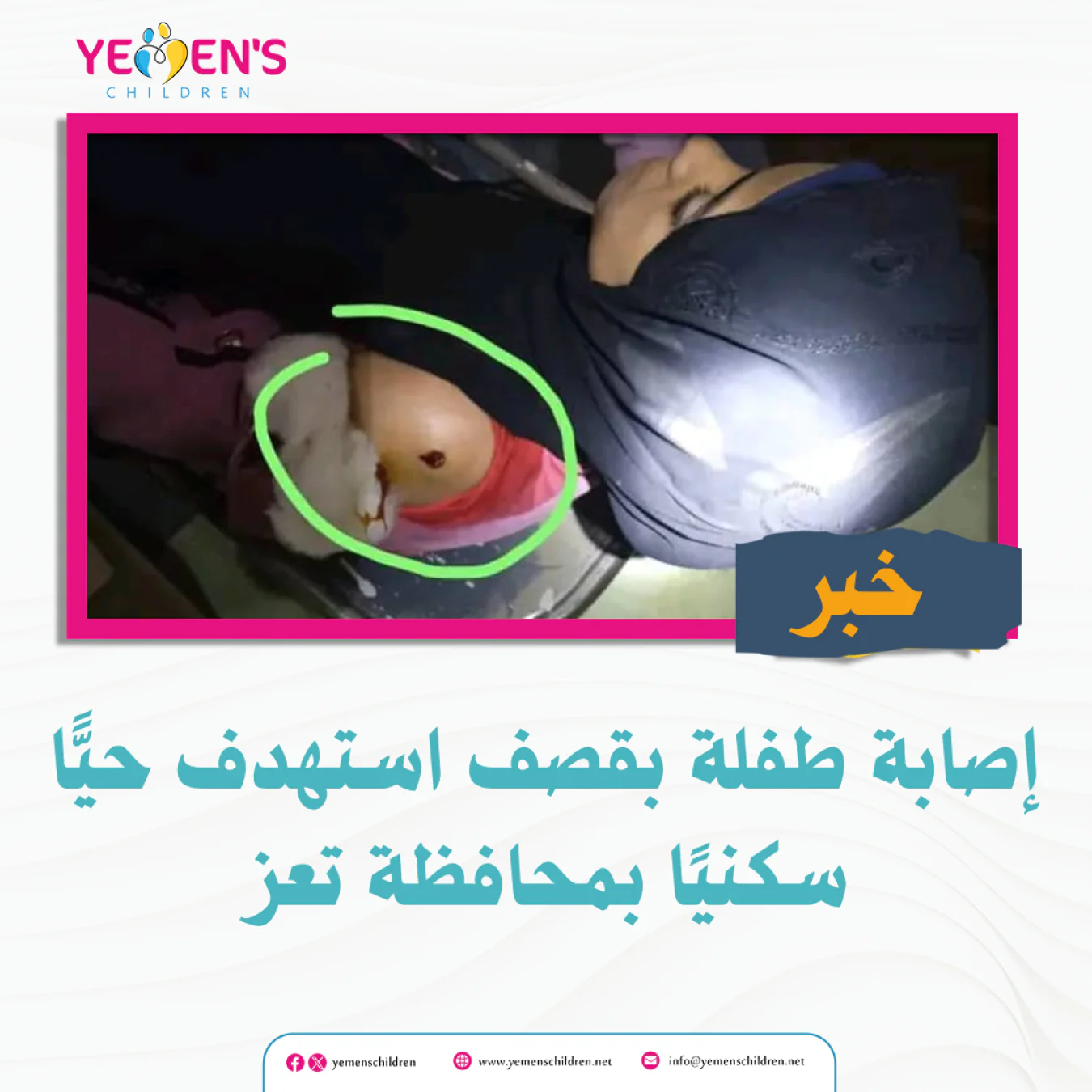 إصابة طفلة بقصف استهدف حيًّا سكنيًا بمحافظة تعز