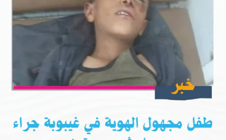 طفل مجهول يدخل في غيبوبة إثر حادث سير في تعز.. وشرطة السير تطلق نداء للتعرف عليه