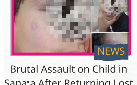 Brutal Assault on Child in Sana'a After Returning Lost Car Key