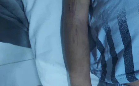 Death of Young Girl Rahaf and Torture of Her Brother Riyaf in Mysterious Circumstances Shake Al-Hodeidah