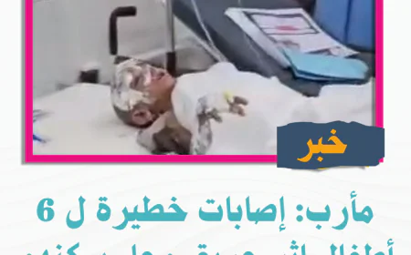 مأرب: إصابات خطيرة ل 6 أطفال إثر حريق محل سكنهم