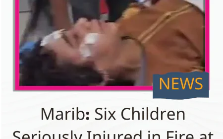Marib: Six Children Seriously Injured in Fire at Their Home