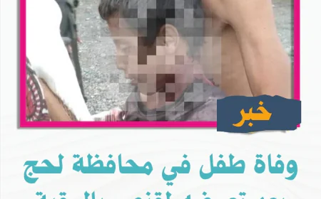 وفاة طفل في محافظة لحج بعد تعرضه لقنص بالرقبة
