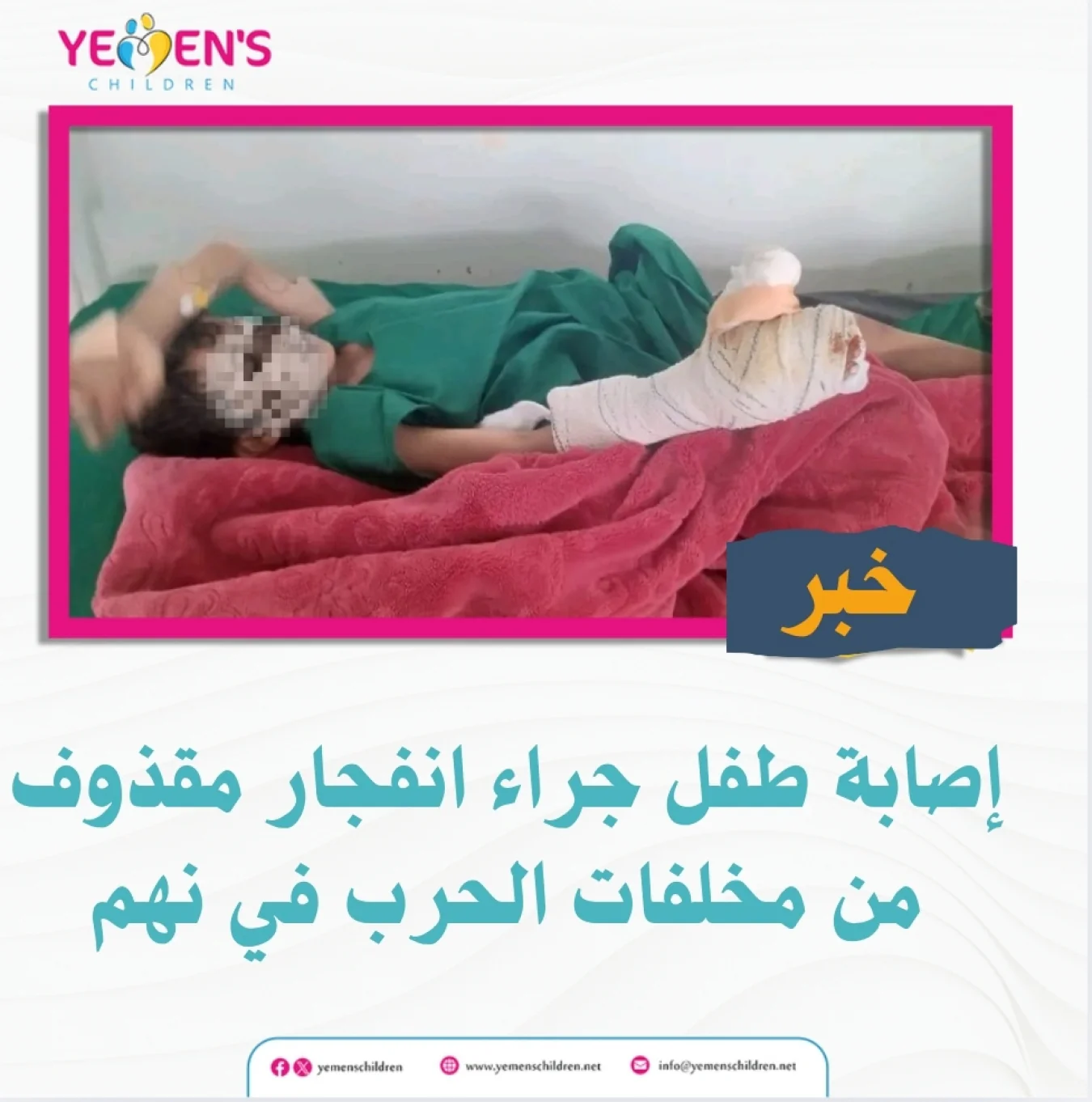 إصابة طفل جراء انفجار مقذوف من مخلفات الحرب في نهم