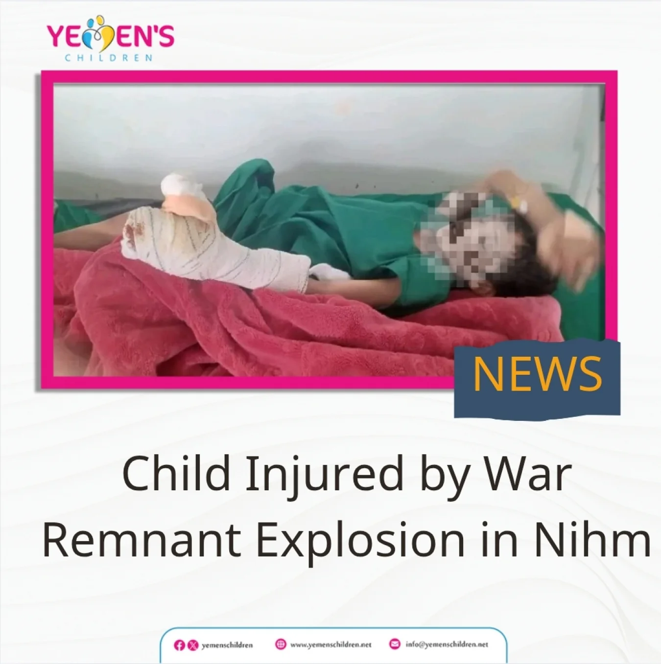 Child Injured by War Remnant Explosion in Nihm