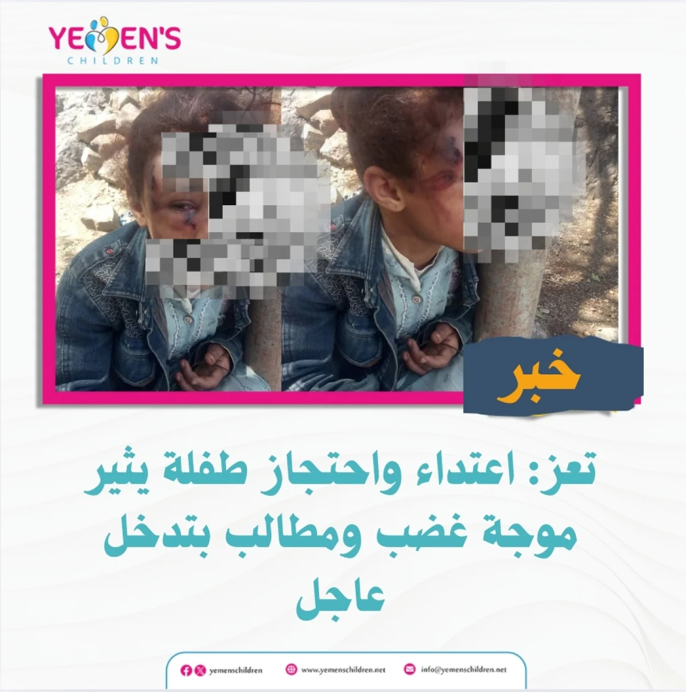 تعز: اعتداء واحتجاز طفلة يثير موجة غضب ومطالب بتدخل عاجل