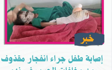إصابة طفل جراء انفجار مقذوف من مخلفات الحرب في نهم