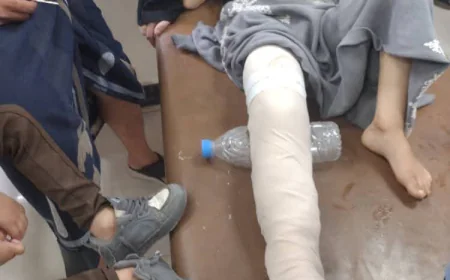 إصابة طفلاً في الثامنة من عمره شرق تعز