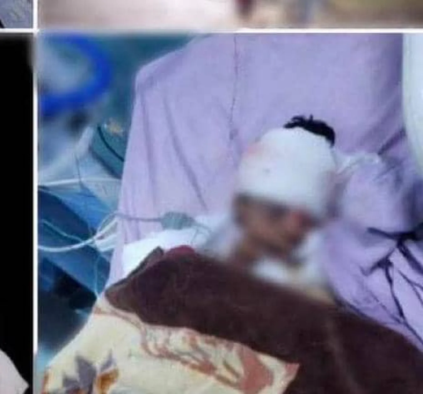 طفل يتعرض لاعتداء وحشي في محافظة عمران.