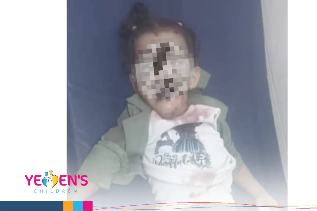 إصابة طفلة في حادث مروري بمحافظة مأرب