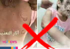 الصورة من  مصر وليست لتعذيب طفلة من قبل زوج ابيها في صنعاء