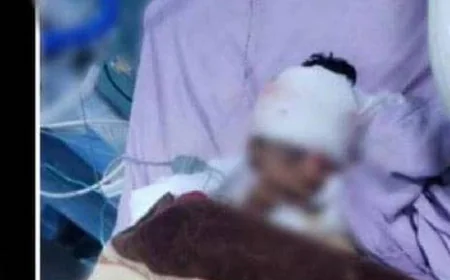 طفل يتعرض لاعتداء وحشي في محافظة عمران.