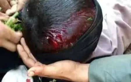 Dhamar: Child Killed by Armed Man in Atma District