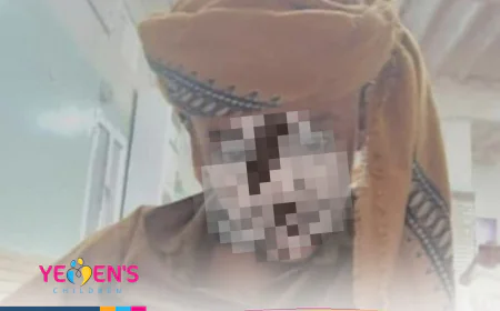 وفاة طفل في محافظة أبين أثناء السباحة